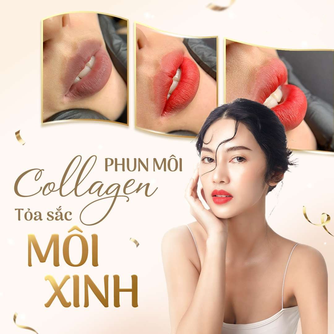 So sánh hình ảnh trước và sau khi phun môi collagen tại Thẩm mỹ Thúy Chu, cho thấy sự khác biệt rõ nét.