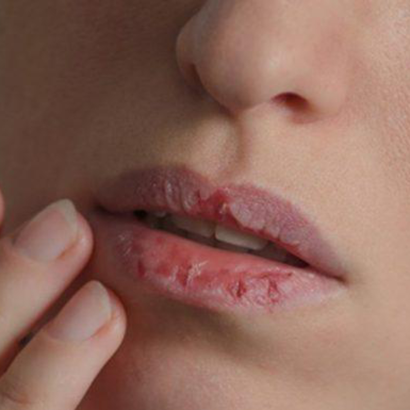 Khi cảm thấy đôi môi khô, nhiều người có thói quen liếm môi để làm ẩm tạm thời. 