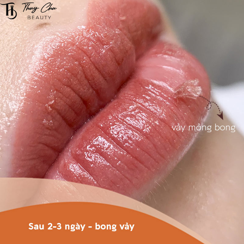 Bóc vảy môi sớm có thể gây mất màu và loang màu