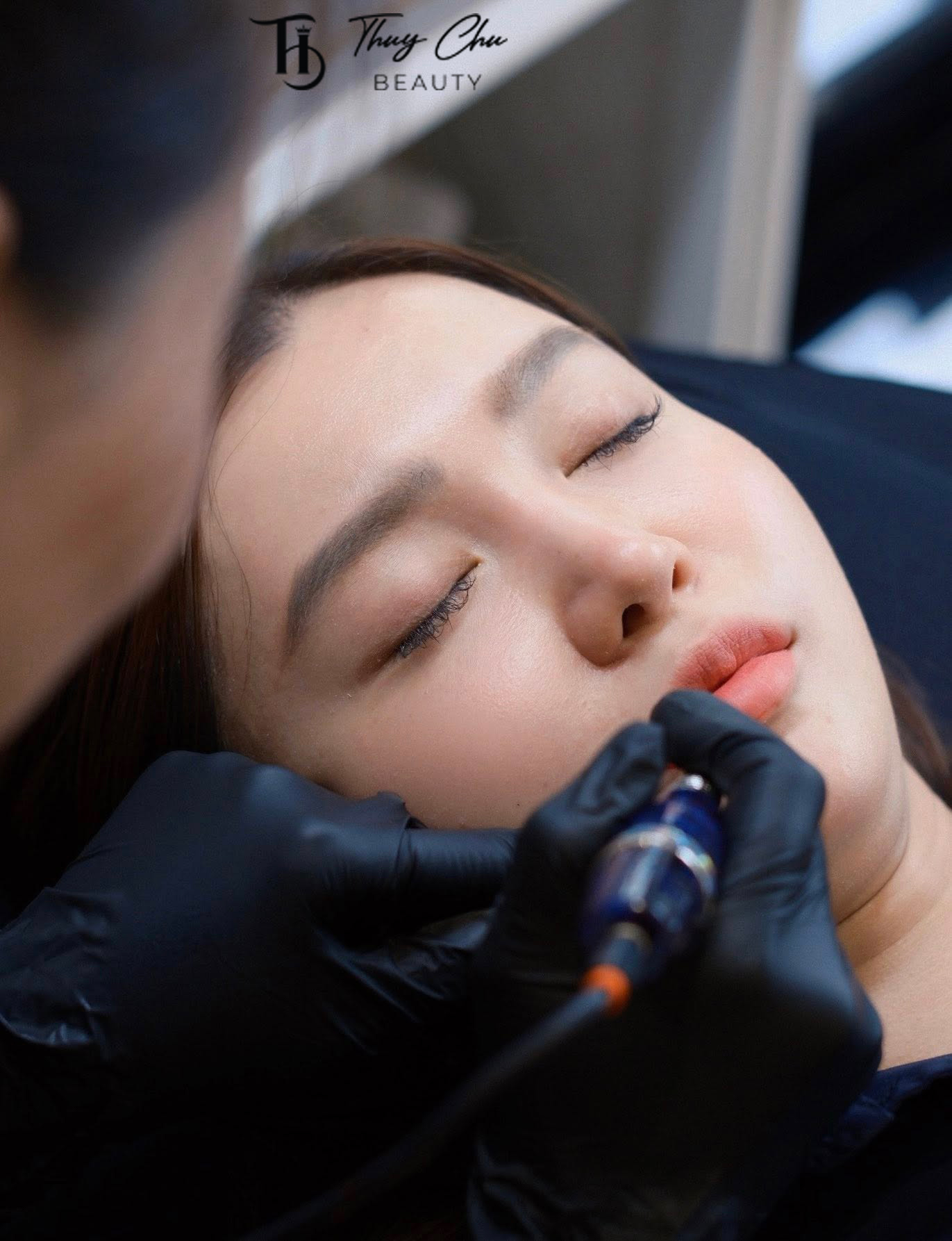 Chuyên viên tại thẩm mỹ Thúy Chu đang phun môi collagen cho khách hàng